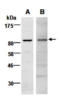 EZH2 (N) Antibody, Rabbit Polyclonal