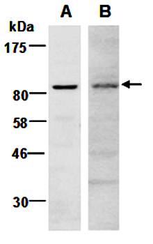 EZH2 (vPairTM) Antibodies