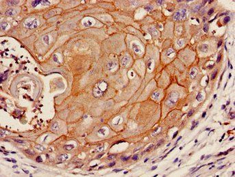F11R Antibody