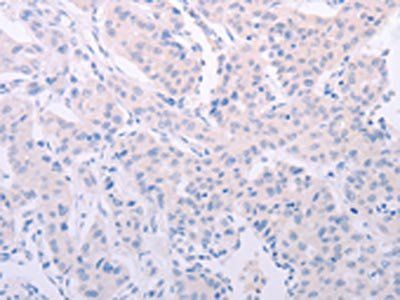 F7 Antibody