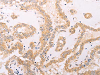 F7 Antibody