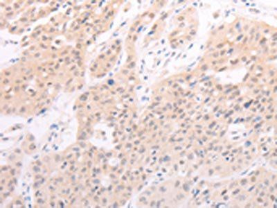 F7 Antibody