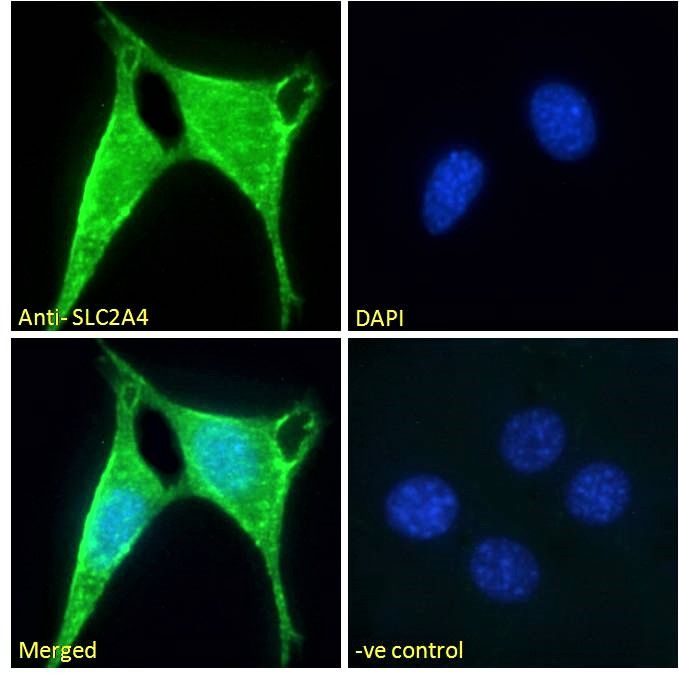 SLC2A4 Antibody