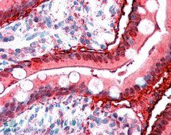 FABP2 Antibody