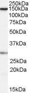 FACT/SUPT16H Antibody