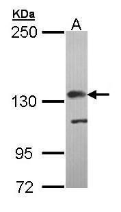 Factor H antibody [N3C1], Internal