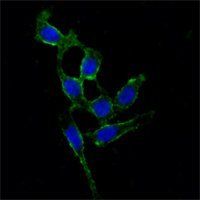 FAK Antibody