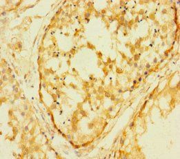 RTL8B Antibody