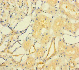 FAM167A Antibody