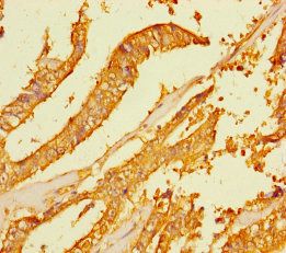 FAM167A Antibody