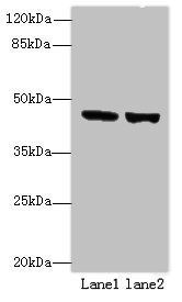 TENT5B Antibody