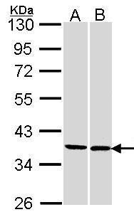 PEF1 Rabbit Polyclonal Antibody