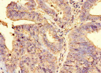 RIPOR2 Antibody