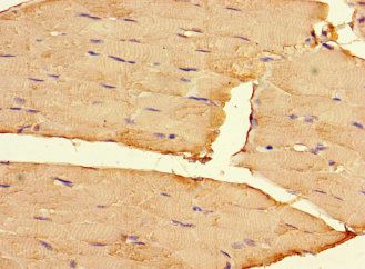RIPOR2 Antibody