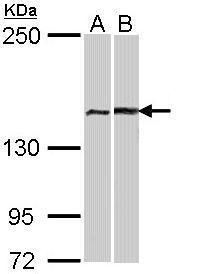 FA complementation group A Antibody
