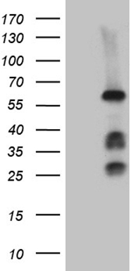 FANCC Antibody