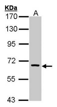 FANCC antibody