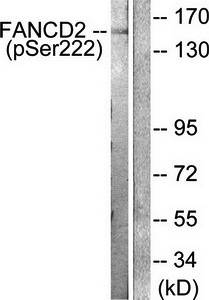 FANCD2 (Phospho-Ser222) Antibody