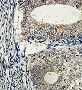 FANK1 Rabbit Polyclonal Antibody