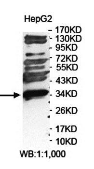 FANK1 Rabbit Polyclonal Antibody