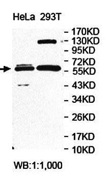 FAR2 Rabbit Polyclonal Antibody