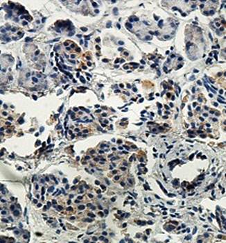 FAR2 Rabbit Polyclonal Antibody