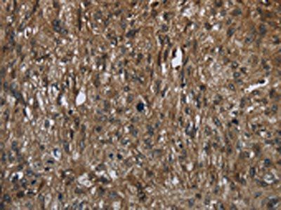 FASTKD2 Antibody