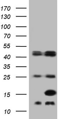 Fatty Acid Binding Protein 5 Antibody