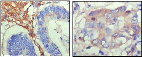 FBLN5 Antibody