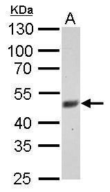 FBXL3 antibody
