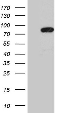 FBXO11 Antibody