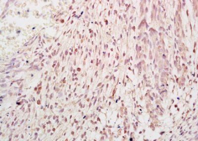 FBXO11 Rabbit Polyclonal Antibody