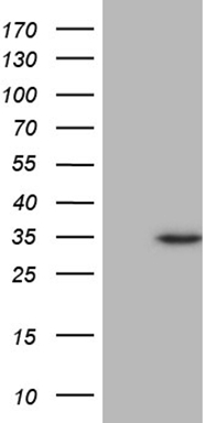 FBXO22 Antibody