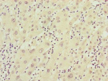 FBXO22 Antibody