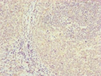 FBXO22 Antibody