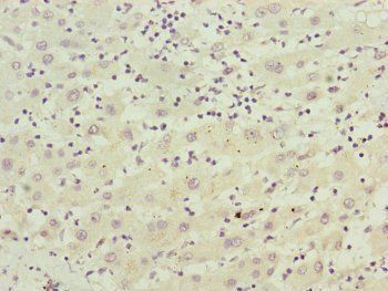 FBXO22 Antibody