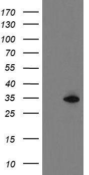 FBXO31 Antibody