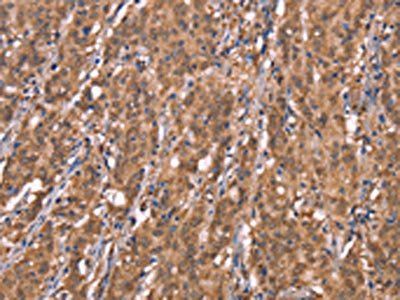 FBXO31 Antibody