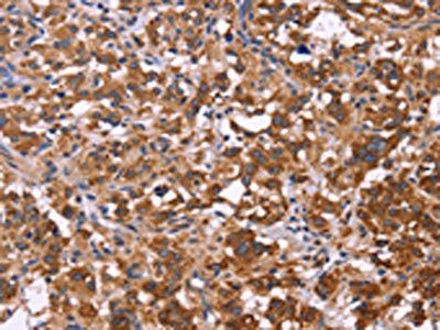 FBXW7 Antibody