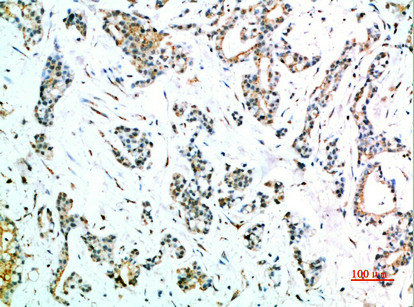 FCGR1A Antibody