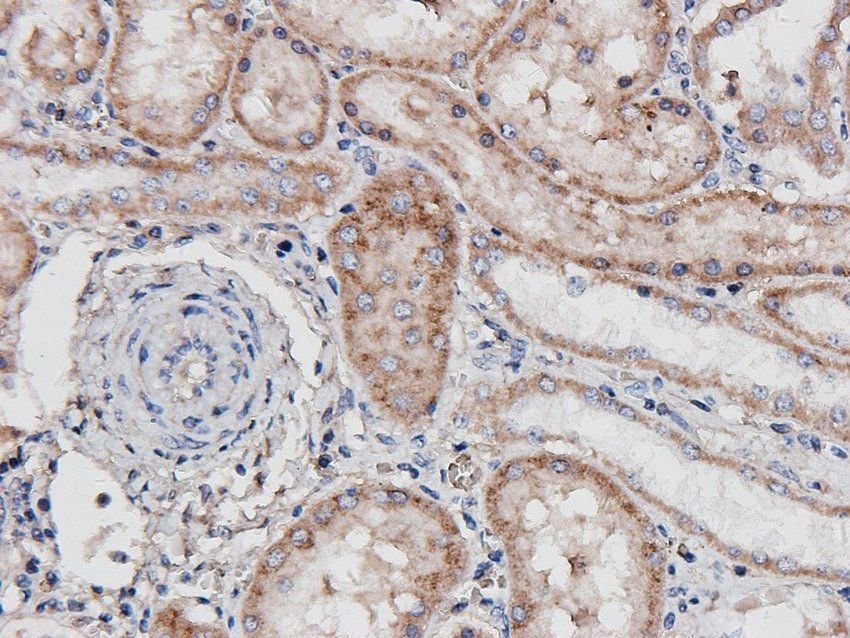 FCRL4 Rabbit Polyclonal Antibody