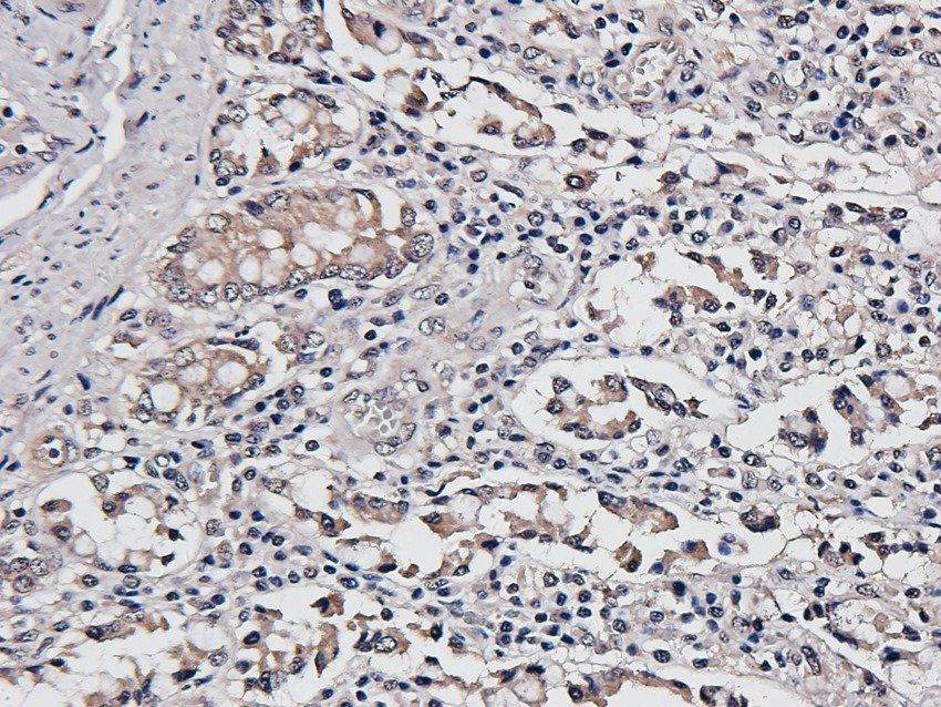 FCRL4 Rabbit Polyclonal Antibody