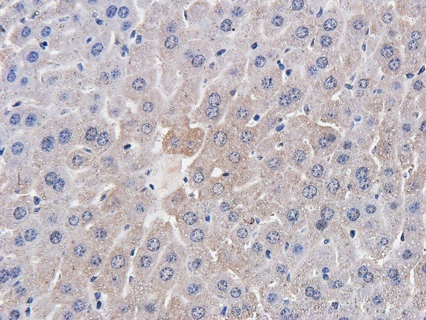 FCRL4 Rabbit Polyclonal Antibody