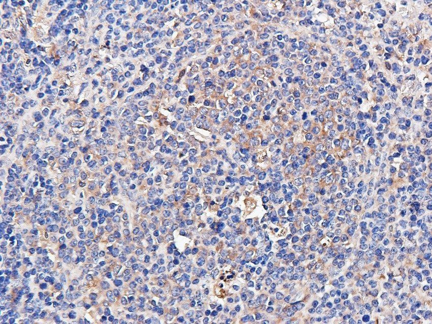 FCRL4 Rabbit Polyclonal Antibody