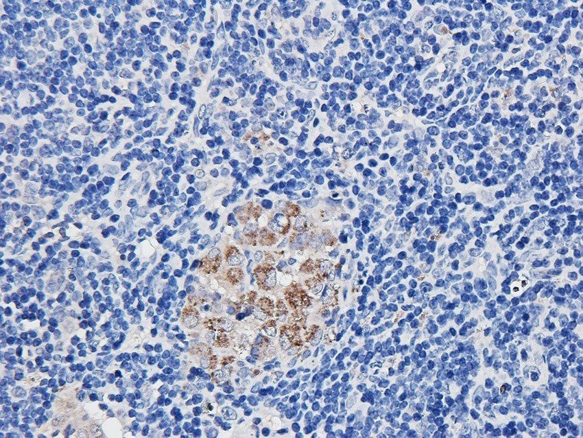 FCRL4 Rabbit Polyclonal Antibody