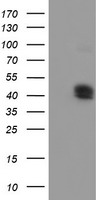FDFT1 Antibody