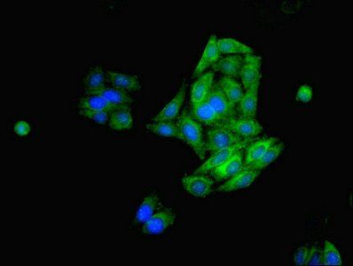FDFT1 Antibody