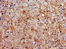 FDFT1 Antibody