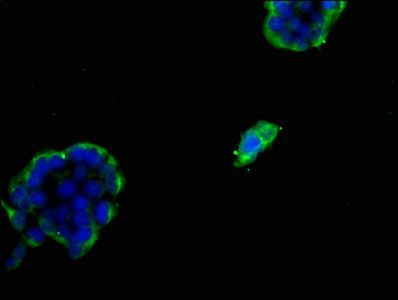 FDFT1 Antibody