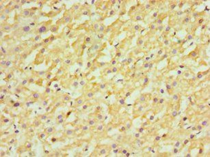 FDFT1 Antibody